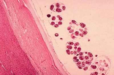 В саратовском мясе обнаружены финноз и эхинококкоз