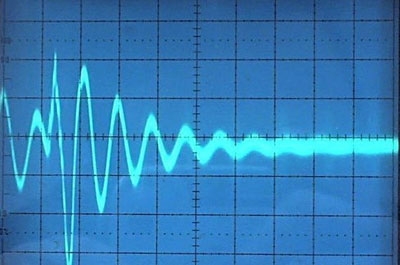 В Саратове пятимесячный мальчик скончался от пневмонии