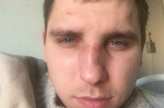 В Саратове избит гражданский активист Евгений Ширманов