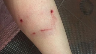 На Большой Горной гулявшую с двухлетним сыном женщину покусала собака