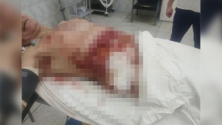 "Собирали по частям": саратовские врачи спасли пациента с 15 колото-резаными ранами