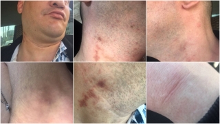 Избиения на проспекте. Еще один пострадавший от рук полиции выступил с обращением