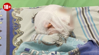 Собака саратовского депутата едва не растерзала ребенка. Владельца ждет суд