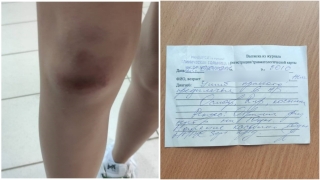 Водитель маршрутки протащил девочку по асфальту. Глава СК поручил возбудить дело