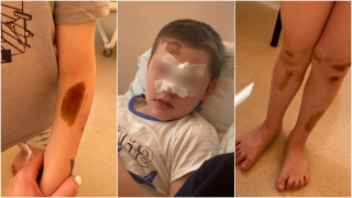 Прокуроры блокируют дело о наезде самокатчика на 5-летнего саратовца. Реакция главы СК