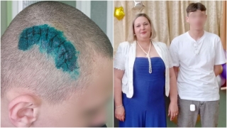 До трепанации черепа. Мать избитого саратовского лицеиста требует наказать виновного