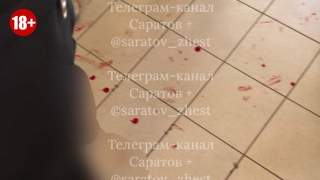 В саратовской школе 11-летний мальчик разбил лоб во время перемены