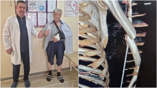 Балаковец едва не потерял руку из-за обмана. Его конечность спасли врачи