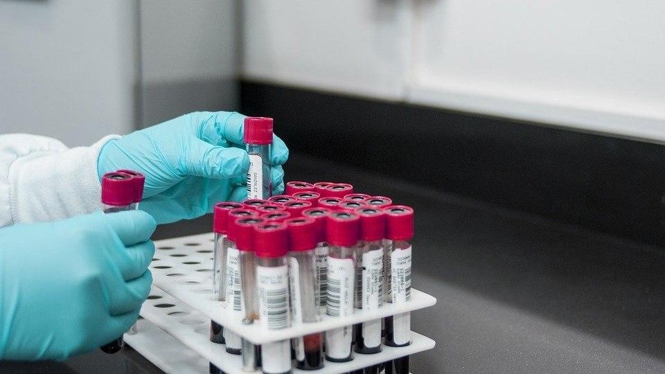 В Саратовской области на коронавирус обследовали 12 граждан из Китая и Италии